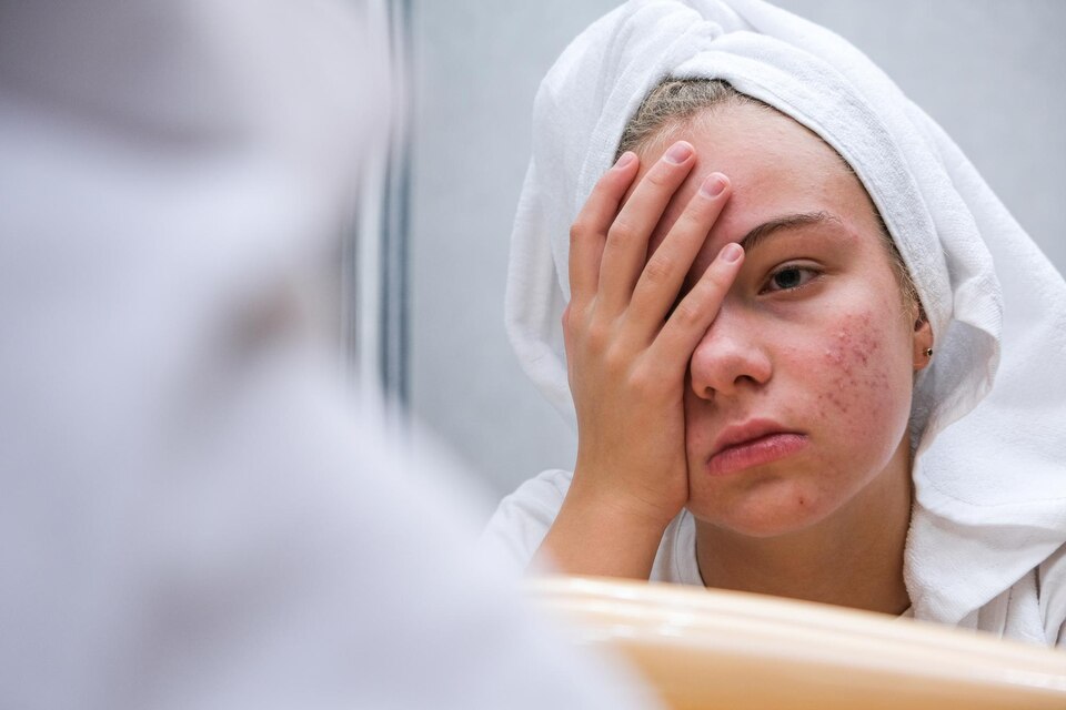 uma mulher com a mão no rosto decepsionada skincare